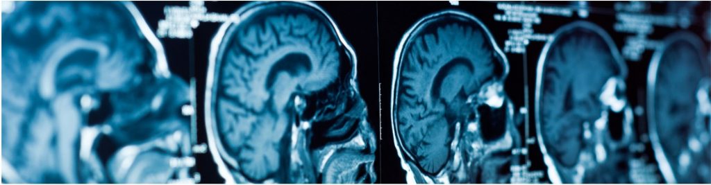 how-does-hypoxic-brain-injury-occur-as-a-result-of-medical-error